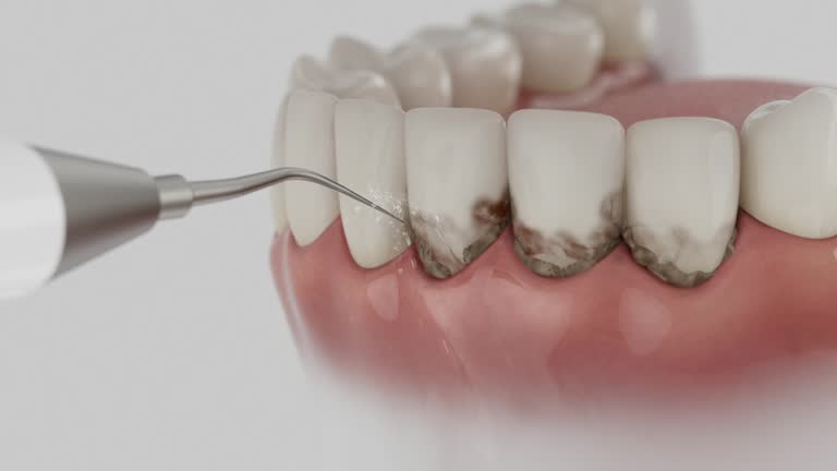 Trusted Dental Crowns And Bridges service in Eddyville, KY - Dentist Open Now